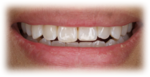 Orthodontics Before Case 4 Orthodontics Before Case 4