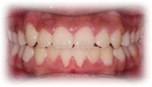 Orthodontics After Case 1 Orthodontics After Case 1