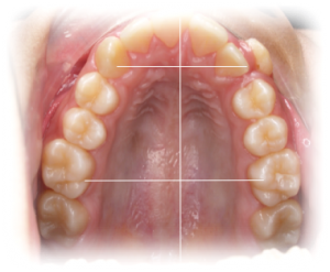 Orthodontics Before Case 2 Orthodontics Before Case 2