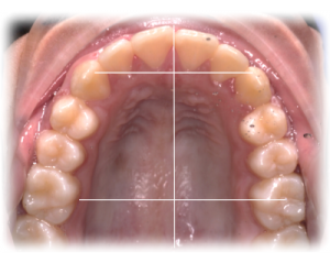 Orthodontics After Case 2 Orthodontics After Case 2